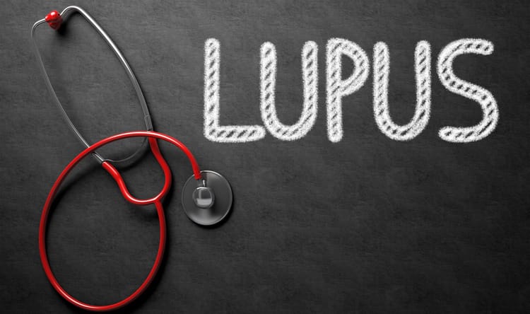 Lupus
