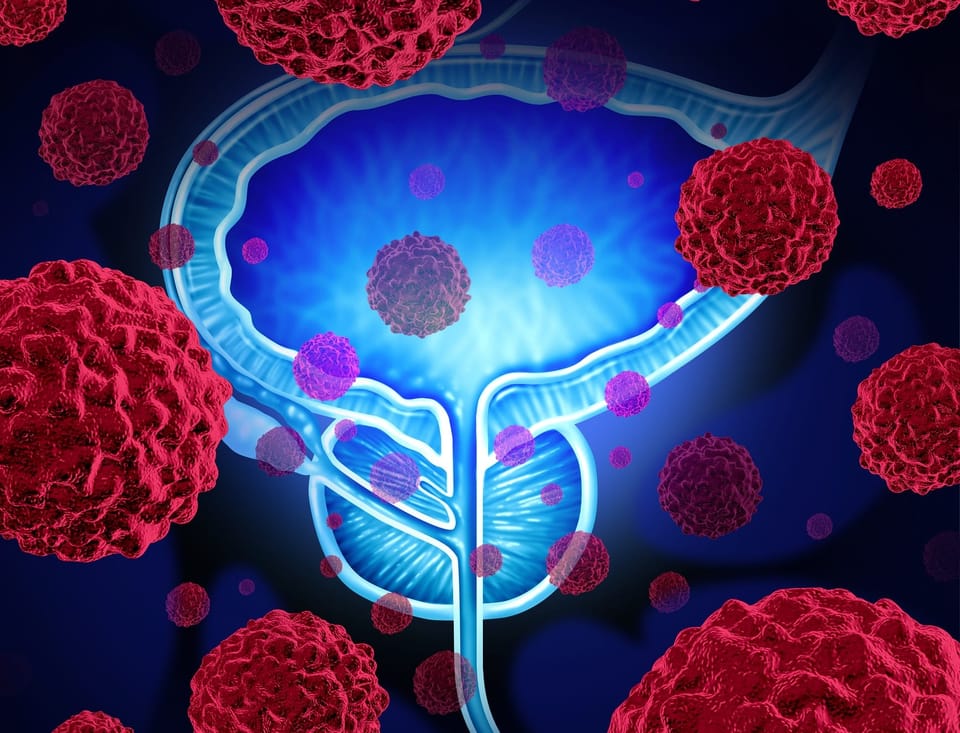 Prostate Cancer